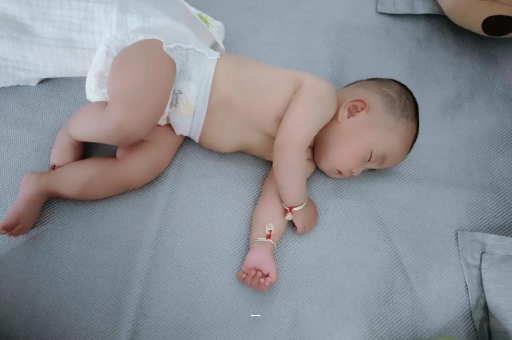 金华宝宝脸上有白色斑块